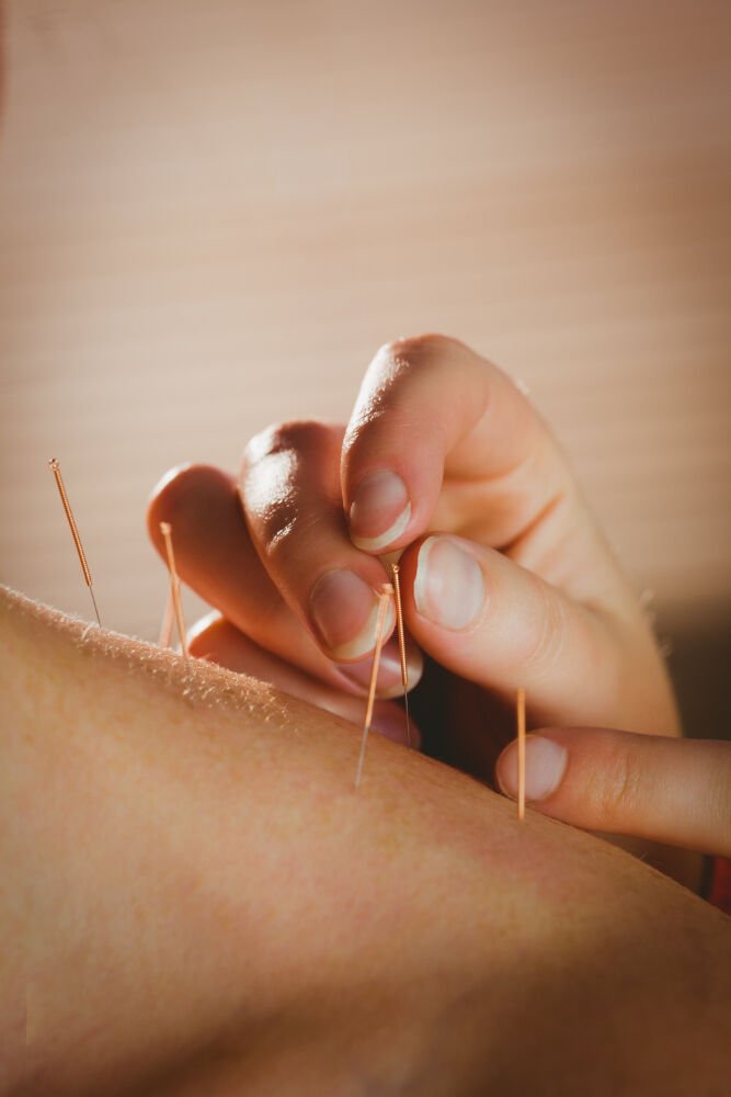 Cork acupuncture therapy and treatment