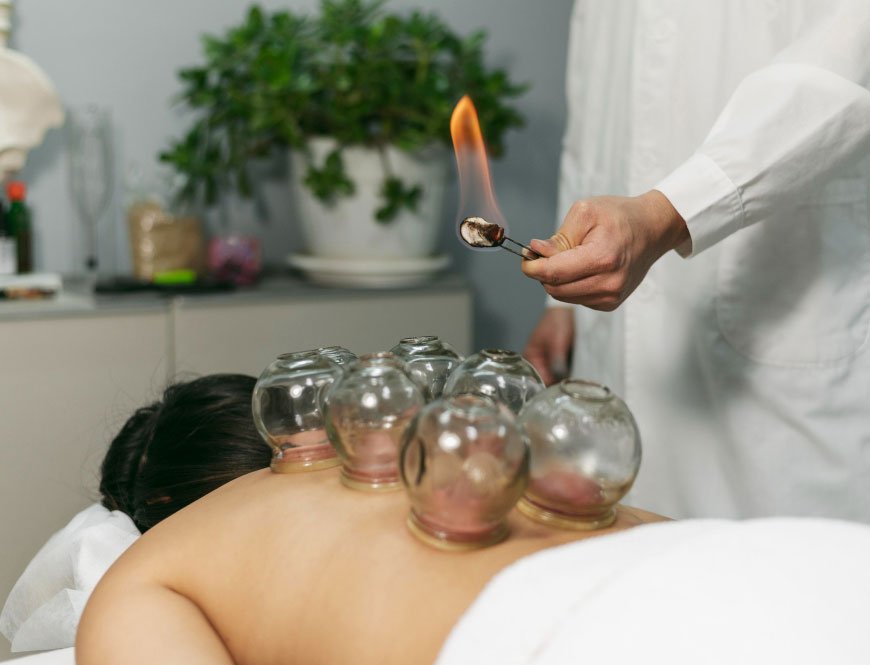 Cupping therapy and treatment in Cork